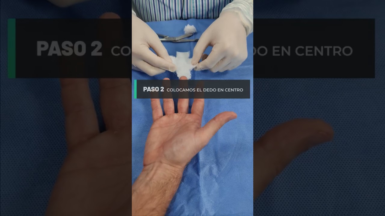 corte en la yema del dedo