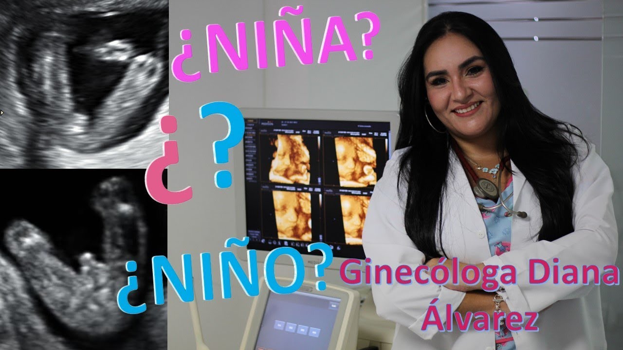 cuando se sabe si es niño o niña