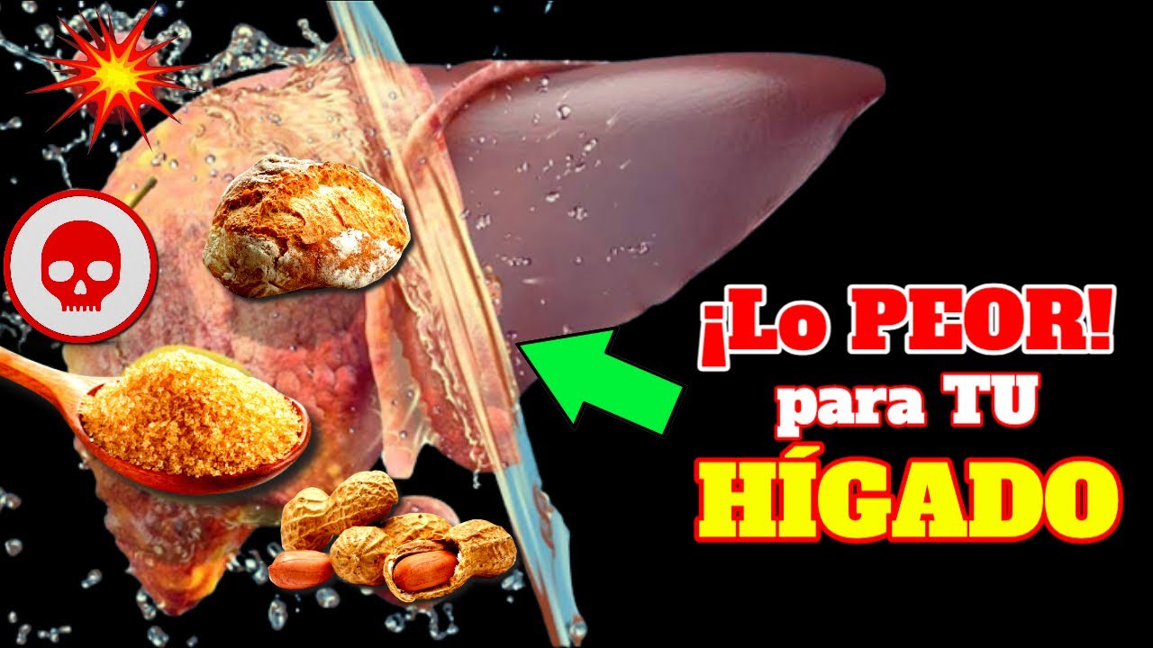 el jamón es malo para el hígado graso