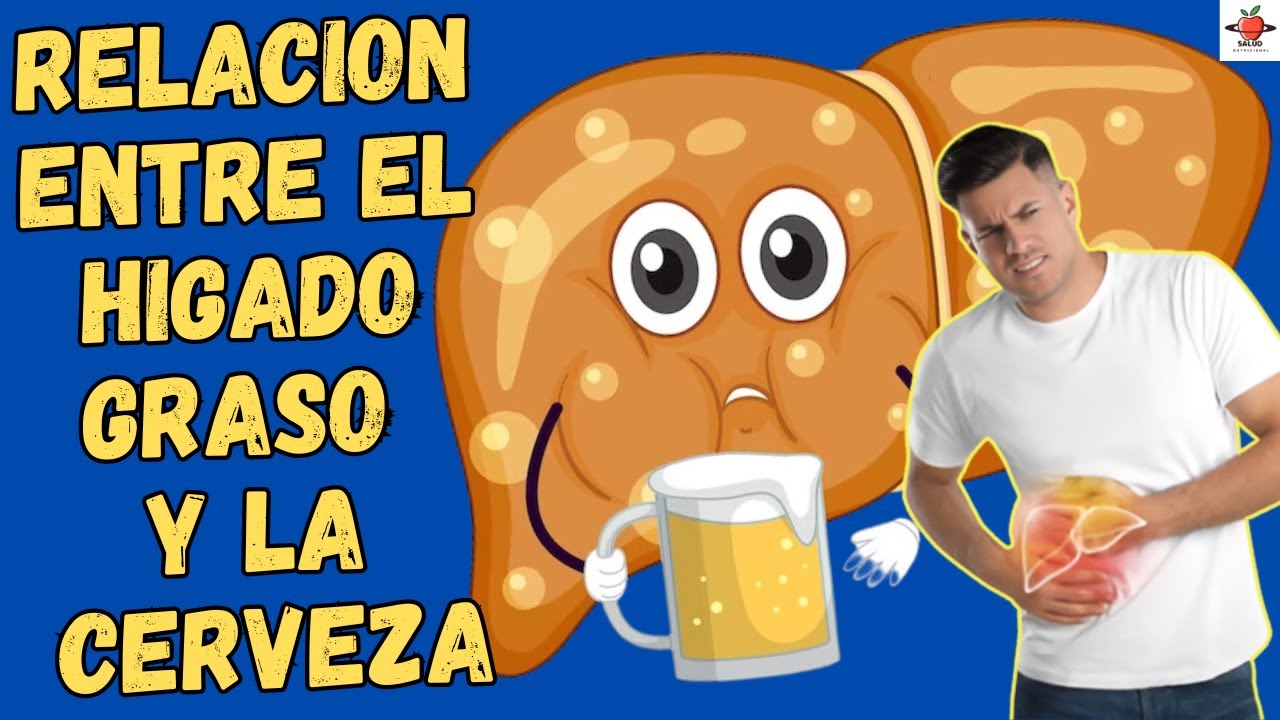 higado graso y cerveza sin alcohol