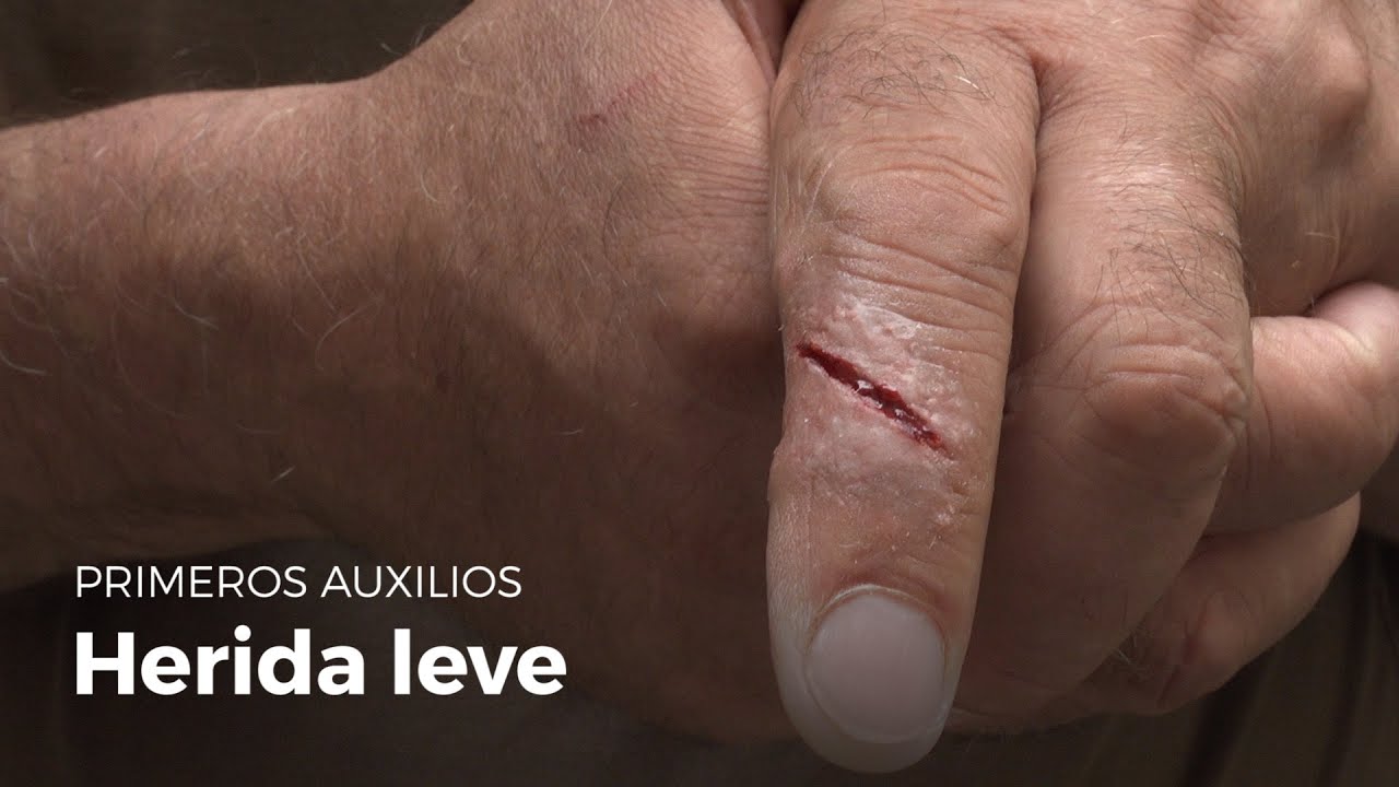 me corte con un cuchillo el dedo