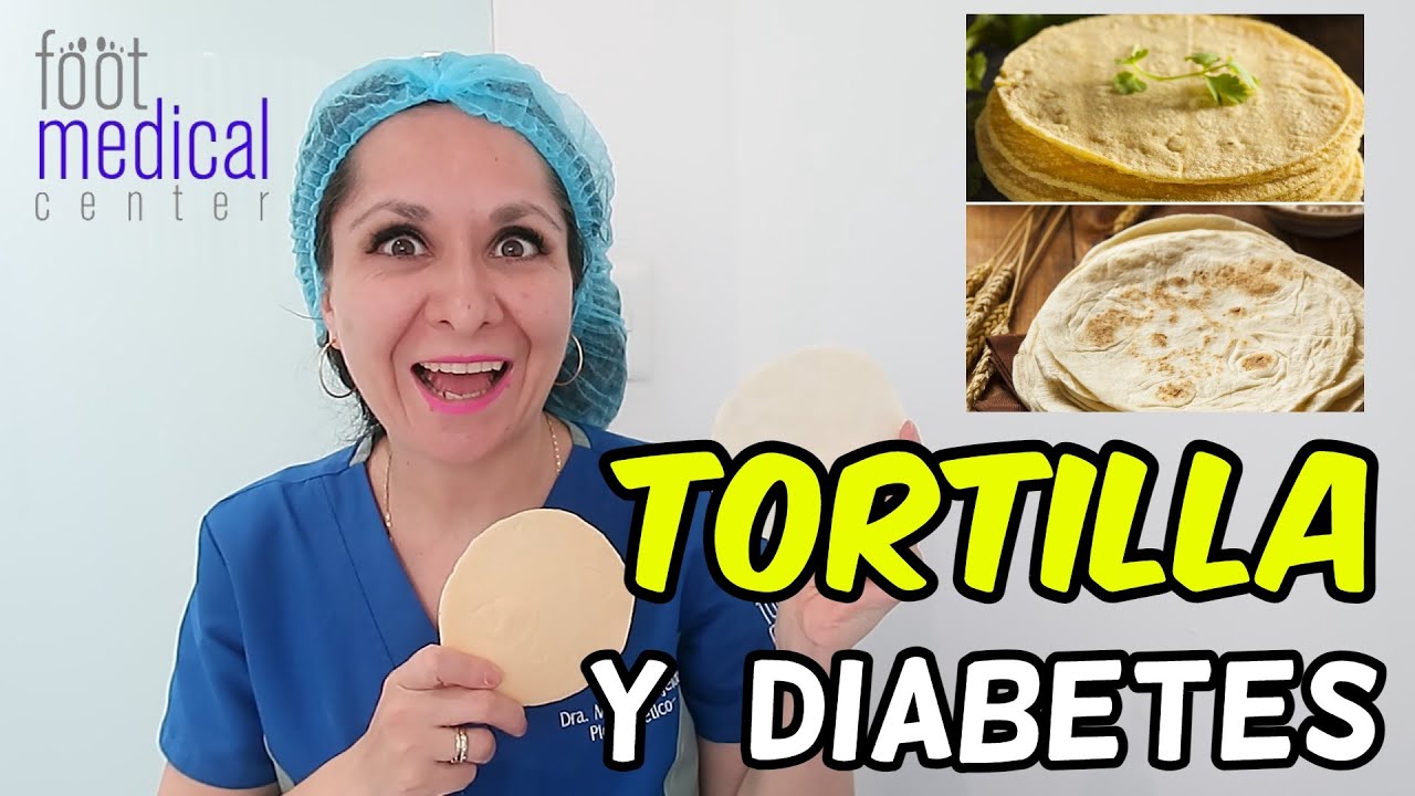 puede un diabetico comer tortilla de patatas