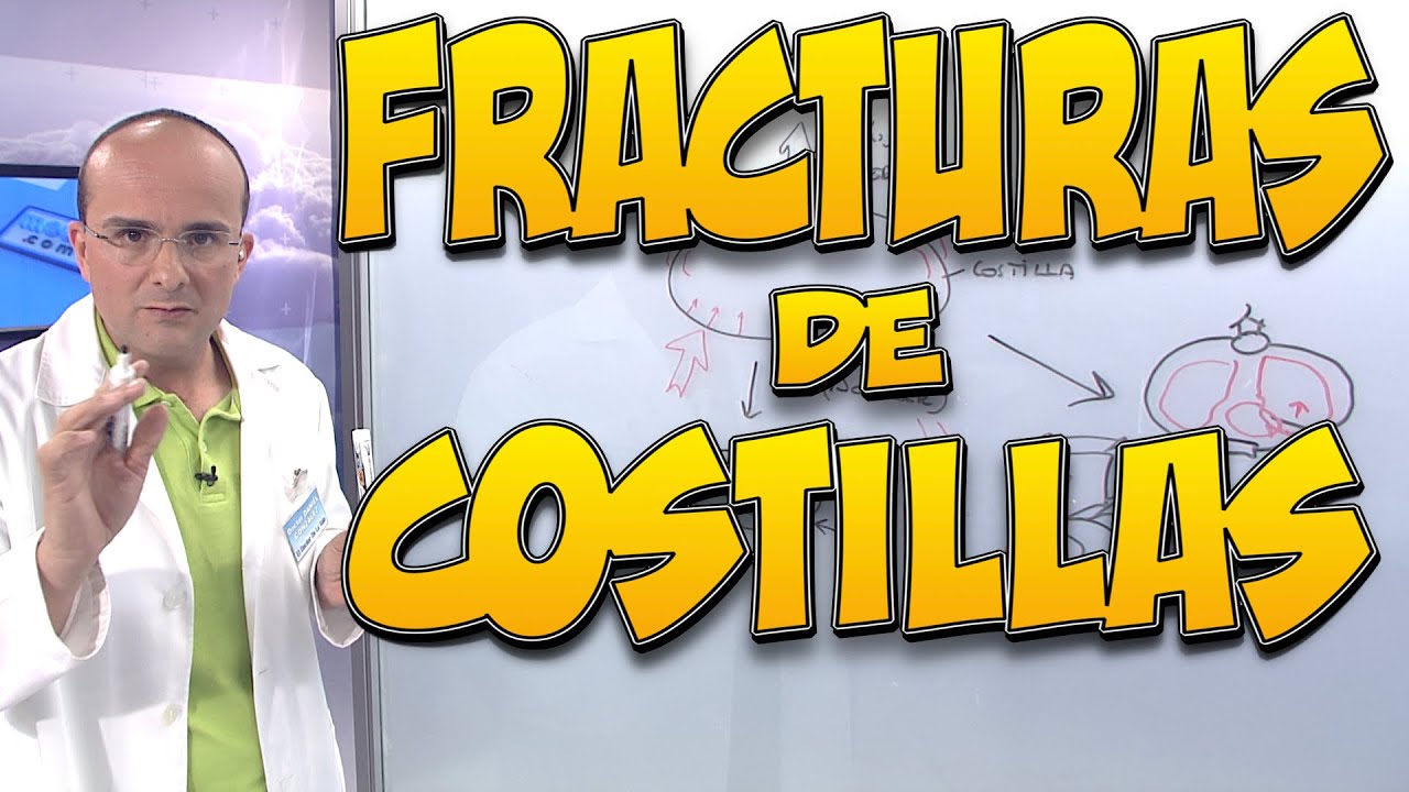 como se cura una costilla rota